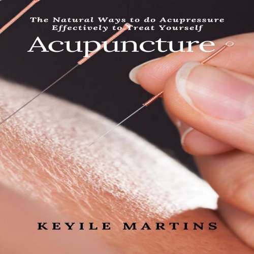 Cover von Acupuncture - Acupuncture - The Natural Ways to do Acupressure Effectively to Treat Yourself