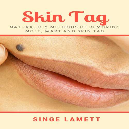Cover von Skin Tag - Skin Tag - Natural DIY Methods of removing Mole, Wart and Skin Tag